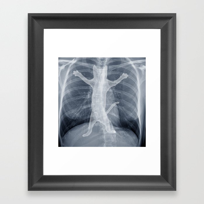 x-ray Framed Art Print
