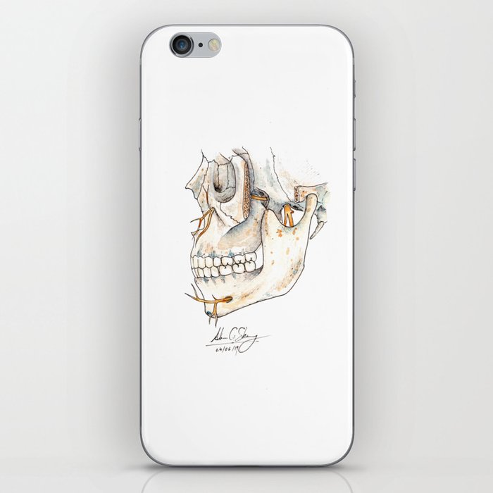 Skull with Trigeminal nerve iPhone Skin