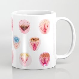 Vulva Diversity – Pink Coffee Mug