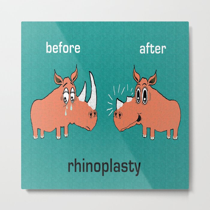 Rhinoplasty Metal Print
