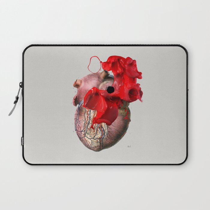 Broken Heart - Fig. 2 Laptop Sleeve