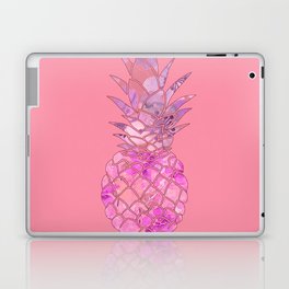 Pink Floral  Pineapple Art Laptop Skin