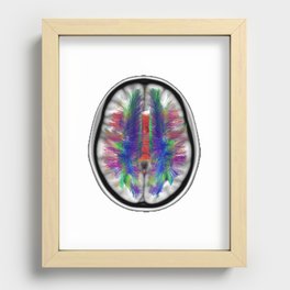Axial Fibers Clear Recessed Framed Print