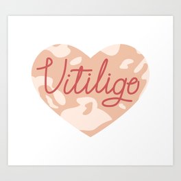 Vitiligo Heart Art Print