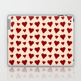 Heart and love 35 Laptop Skin