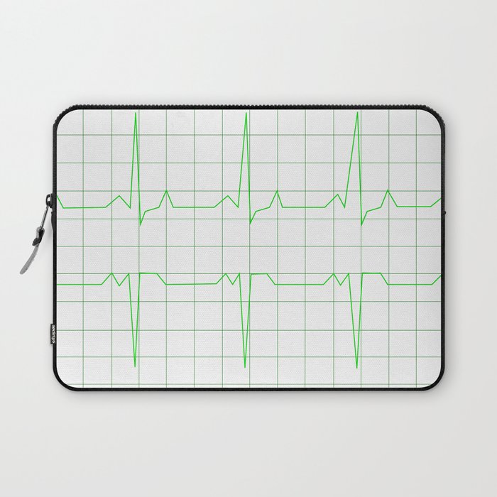Normal Heart Rhythm Laptop Sleeve