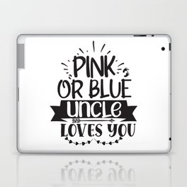 Pink Or Blue Uncle Loves You Laptop Skin