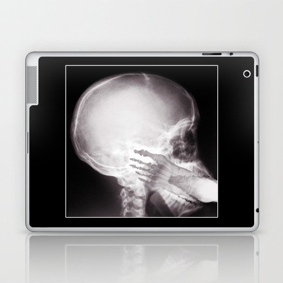 Foot In Mouth X Ray Laptop Ipad Skin By Gx9designs Society6