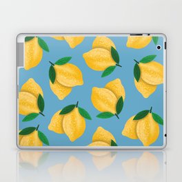 Summer Lemon Pattern Blue Laptop Skin