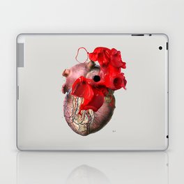 Broken Heart - Fig. 2 Laptop & iPad Skin