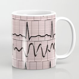 Cardiac Rhythm Strips EKG Coffee Mug