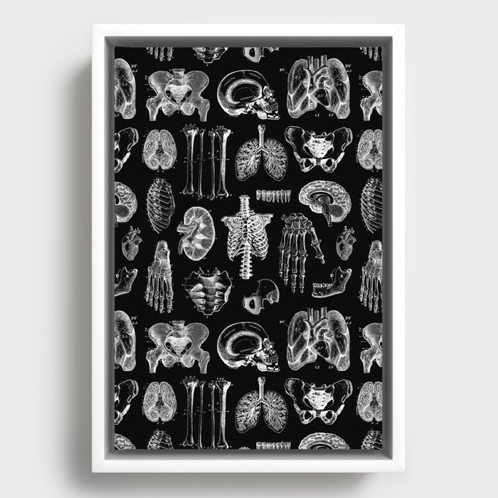 Framed Canvas