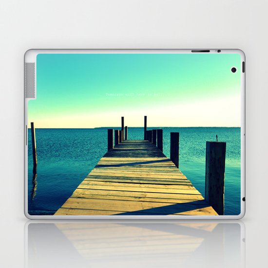 Tomorrow Will Have to Wait Laptop & iPad Skin