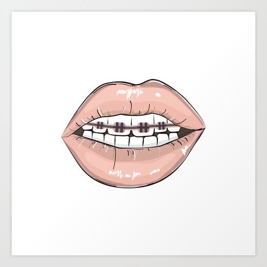 Lips vs braces Art Print