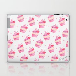 Bite Me Cupcake - Pink Laptop Skin
