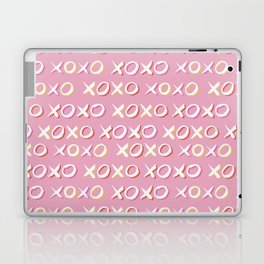 Pink XOXO Pattern Laptop Skin