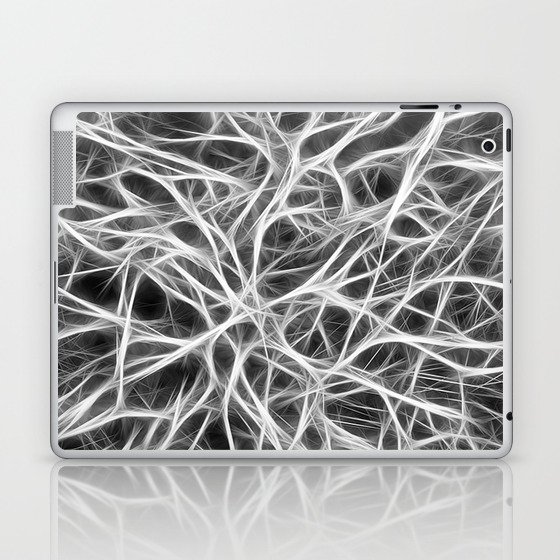 NERVE CELLS. Get on my nerves. Laptop & iPad Skin