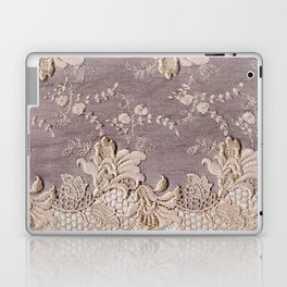 Burlap Lace 8 Laptop Skin