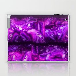 Purple Glitch Stripes Laptop Skin