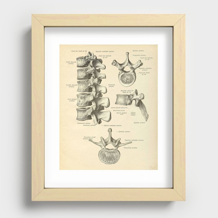 Vintage Human Vertebrae Anatomy Print Recessed Framed Print