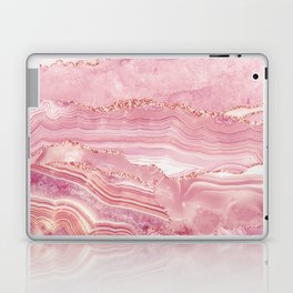 Pink Glamour Marble Agate  Laptop Skin