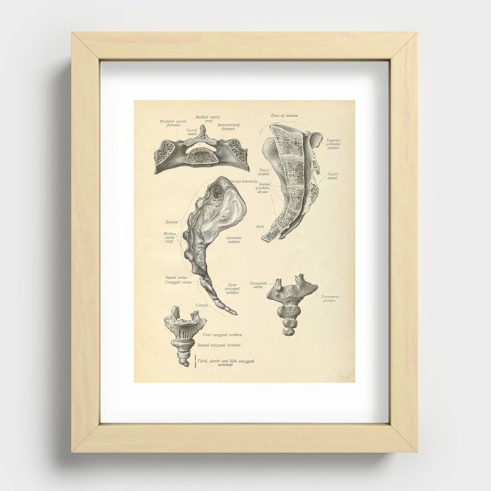 Vintage Human Sacrum Anatomy Print Recessed Framed Print