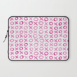 Xoxo valentine's day - pink Laptop Sleeve