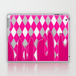 Pink Silver Plaid Dripping Collection Laptop Skin