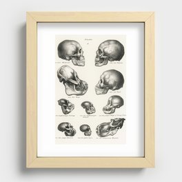Vintage Old Illustration Of Different Skulls Recessed Framed Print