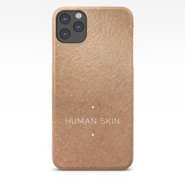 human skin iPhone Case