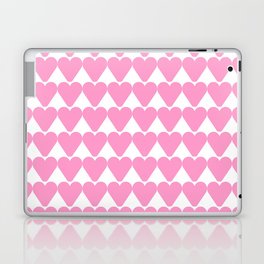 Heart and love 39 Laptop Skin