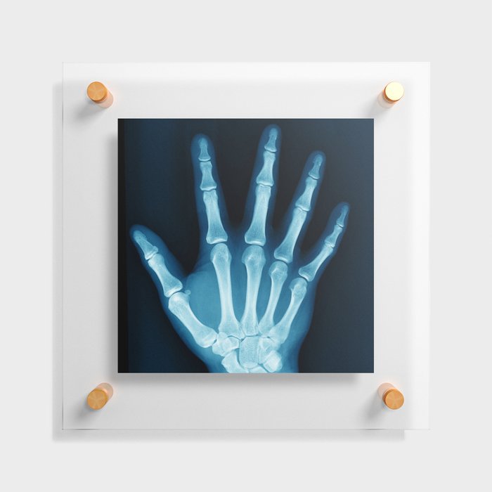 Hand X-Ray Floating Acrylic Print