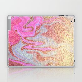 Glitter Marble Laptop Skin