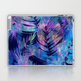 Waikiki Tropic {Blue} Laptop & iPad Skin