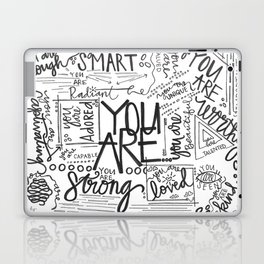 YOU ARE (IV- edition) Laptop Skin