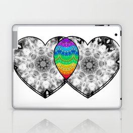 You Color My World - Colorful Love Heart Art Laptop Skin