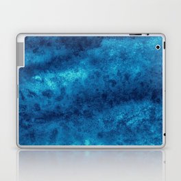 Turn Out the Lights Laptop Skin