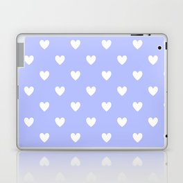 Periwinkle Collection - hearts1 Laptop Skin