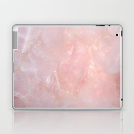 Rose Quartz Laptop Skin