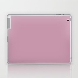 Pink Honey Laptop Skin
