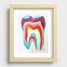 Polarised tooth2 Recessed Framed Print