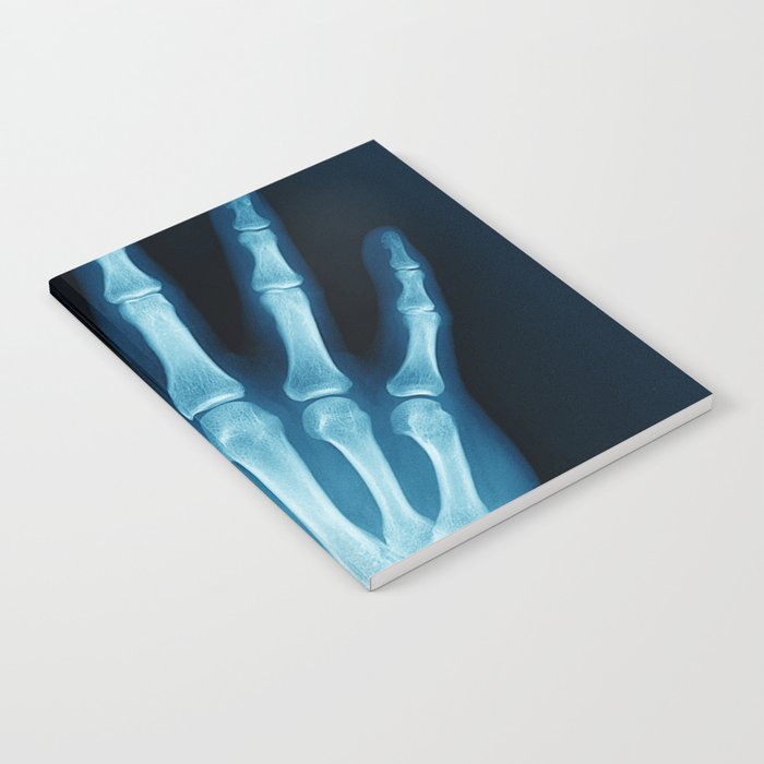 Hand X-Ray Notebook