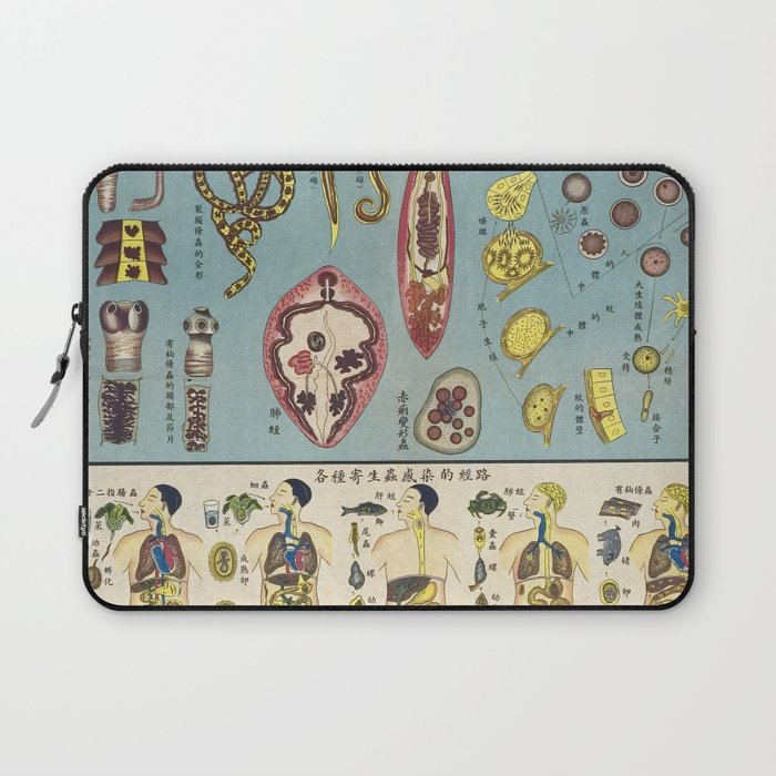 Chinese Parasite Chart Vintage Poster Anatomical  Laptop Sleeve