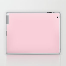 Thousand Kisses Pink Laptop Skin