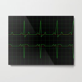 Normal Heart Rhythm Metal Print | Beat, Rhythm, Heart, Blood, Electrocardiogram, Life, Heartbeat, Test, Analysis, Graphic 