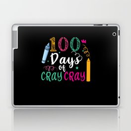 Day Of School 100th Day Color Colorful Art Cray Laptop Skin