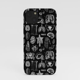Human Anatomy Black & White iPhone Case