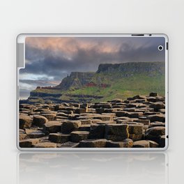 Giants Causeway Laptop & iPad Skin