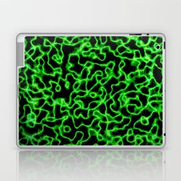 Green in Black Laptop Skin