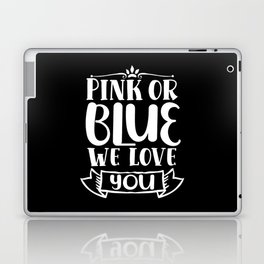 Pink Or Blue We Love You Laptop Skin